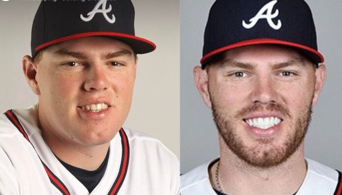 Freddie Freeman before and after picture with teeth visible